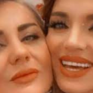 Nuk iu shpëton as motra e Edona Llalloshit, i zbulohet ndërhyrja në fytyrë që e ka bërë