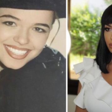 poni Poni i ka rënë pishman për këtë ndërhyrjet estetike në fytyrën e saj