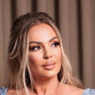 violeta Violetë Kukaj e ka tepruar me ndërhyrje, nuk po njihet më me këtë pamje të ekzagjeruar