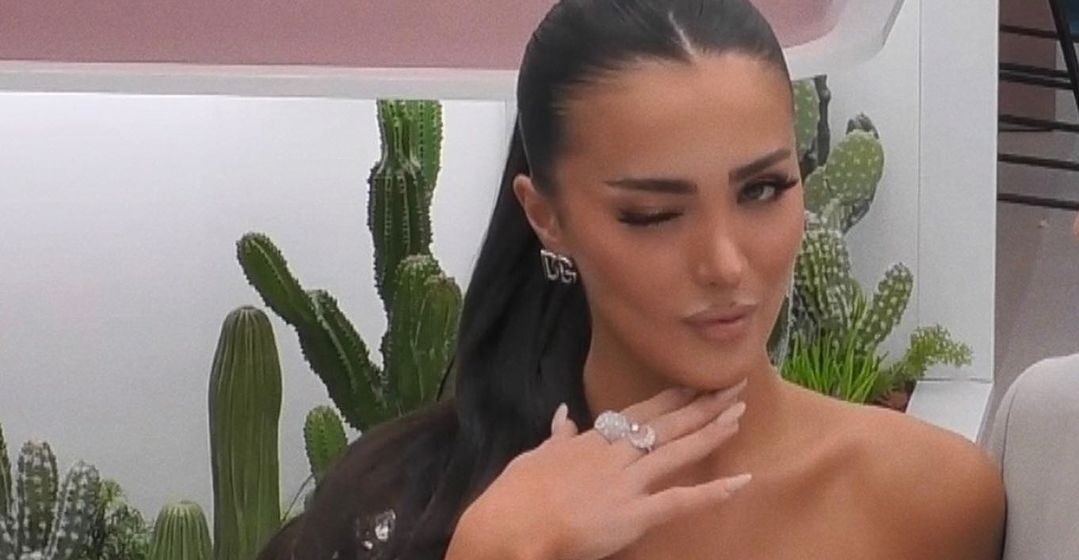 Alba8 Tani duket e bukur dhe seksi, por nuk do ta besoni si ishte Alba pa operacione, me hundën origjinale