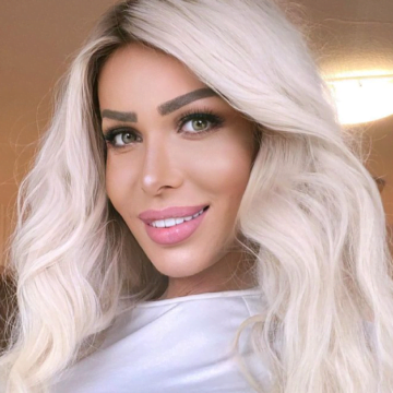 Transformimi që tronditi të gjithë, nuk do ta besoni si duket tani Edona James