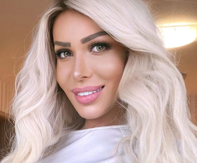 Transformimi që tronditi të gjithë, nuk do ta besoni si duket tani Edona James