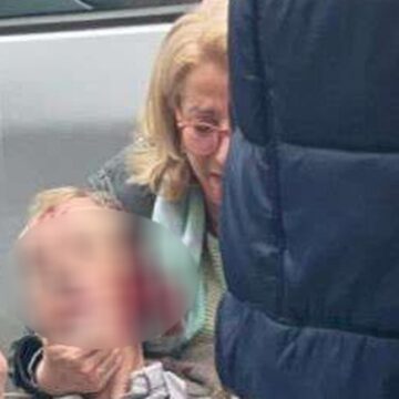 Shkurta në gjendje të rëndë pasi ia shkeli vetura burrin, dalin pamjet ku ajo qan në zë (PAMJE)