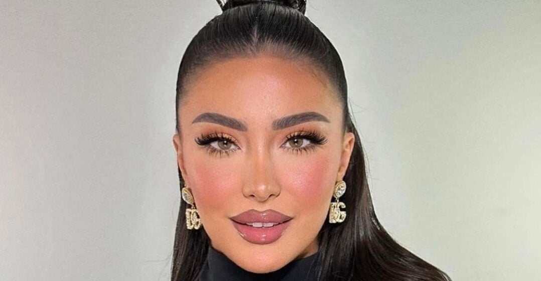 Alba është “tranu” krejt prej që ka dalë nga Bigu, sapo provokoi rëndë duke ekspozuar të pasmet