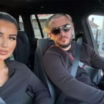 Gruaja e Gold AG mezi po merr frymë nga operacionet plastike, shokon me pamjen e fundit