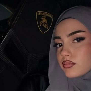 hati Hati na zbuloj suprizën më të madhe ndonjëherë, ajo do të jetë shumë shpejt një ndër prezantueset më të bukura shqipëtare