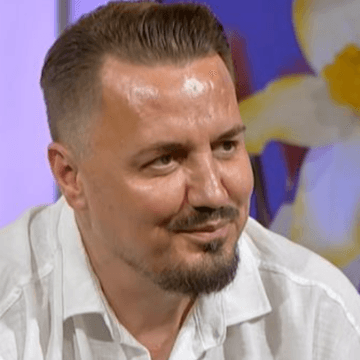 Blero më në fund e pranoi, ja se në cilën klinikë i bëri ai ndërhyrjet-fillerin dhe botoxin