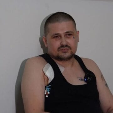 E dhimbshme, rrëfehet Greku: Si e humba këmbën e djathtë për dy ditë