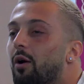 Po kalon periudhën më të errët të jetës së tij, Gjesti më në fund tregon problemin me të cilin po përballet këto ditë