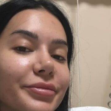 Pak ditë pas operacionit, Efi merr vendimin të tregojë se çka i ndodhi – nuk paska qenë gjë e vogël