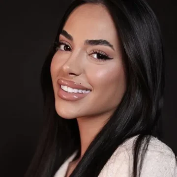 2024-01-img-6460-1-jpeg Kaderi ka mahnitur me pamjen e saj të re, afër bredhit shkëlqen dhe duket plot stil