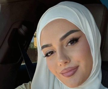 Hati para se të bëhej e famshme dukej krejt ndryshe, do të befasoheni kur ta shihni