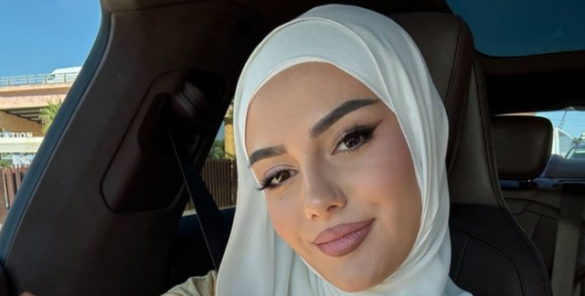 IMG_5656 Hati para se të bëhej e famshme dukej krejt ndryshe, do të befasoheni kur ta shihni