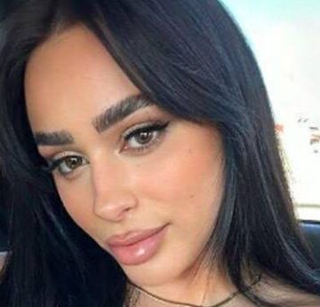 IMG_6561 Egli ka tërhequr vëmendjen me postimin e fundit, diçka e çuditshme vërehet tek buzet e saj, i janë shtrembëruar apo e ka bërë për klikime