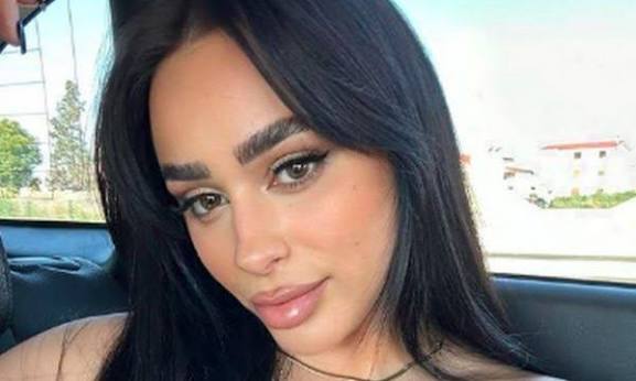 Egli ka tërhequr vëmendjen me postimin e fundit, diçka e çuditshme vërehet tek buzet e saj, i janë shtrembëruar apo e ka bërë për klikime