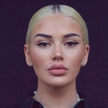 IMG_6931 Çka ka ndodhur me Loredanën? Nuk do ta besoni si është bërë, asht e lëkurë – s’po njihet më