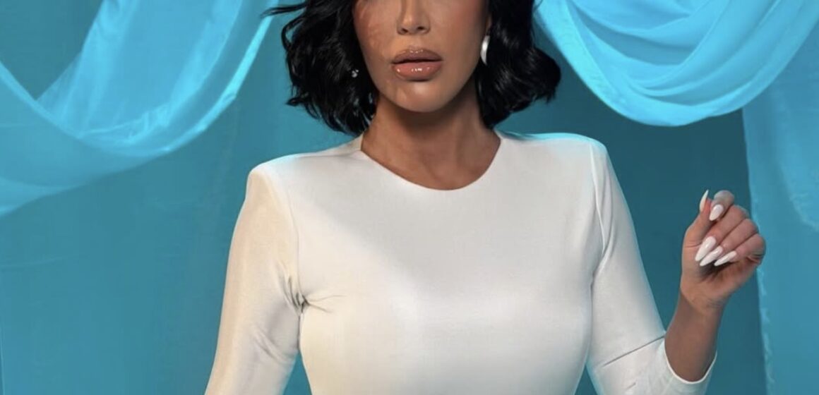 Dashuria nuk njeh moshë, Teuta Selimi e rigjenë dashurinë në pleqëri, bëhet nuse me fustan të bardhë