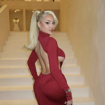 Benita-0 Benita bën intervenimin tjetër estetik në fytyrë, kështu po duket tani